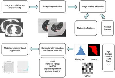 Application of radiomics in diagnosis and treatment of lung cancer